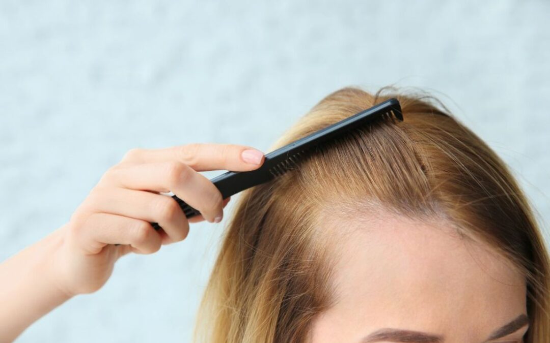 Caduta dei capelli donna: tutto quello che devi sapere