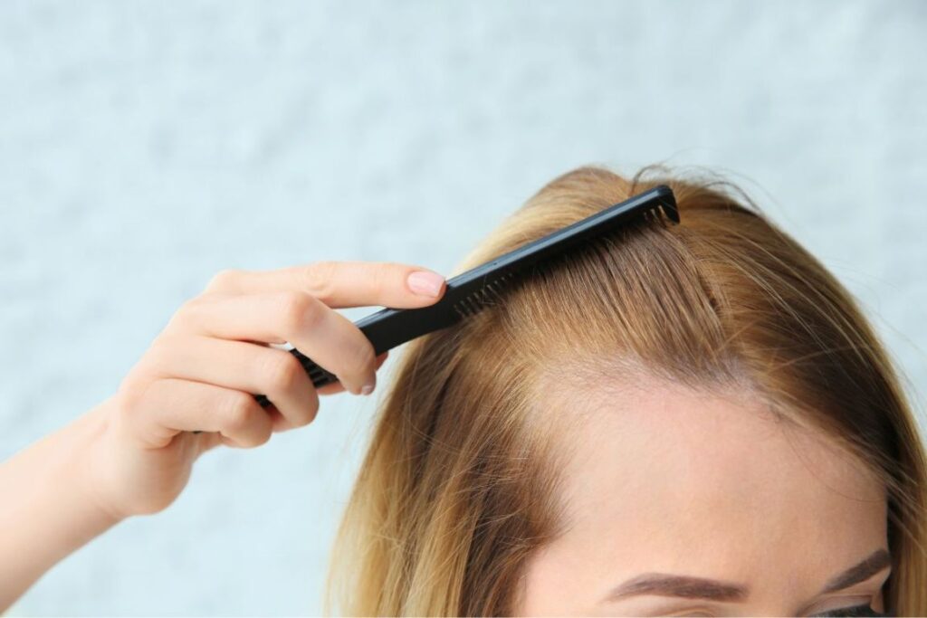 Mano che scosta i capelli con un pettine nero mostrando una riga con diradamento sulla fronte